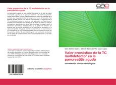 Bookcover of Valor pronóstico de la TC multidetector en la pancreatitis aguda