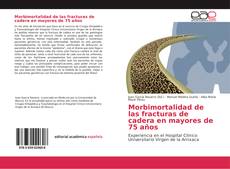 Bookcover of Morbimortalidad de las fracturas de cadera en mayores de 75 años