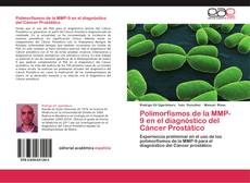 Buchcover von Polimorfismos de la MMP-9 en el diagnóstico del Cáncer Prostático