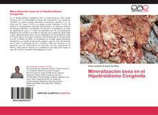 Portada del libro de Mineralización ósea en el Hipotiroidismo Congénito