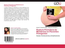 Ruptura Prematura de Membrana en Pacientes Primigestas kitap kapağı