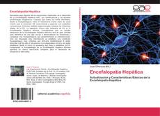 Bookcover of Encefalopatía Hepática