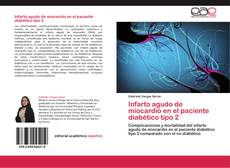 Bookcover of Infarto agudo de miocardio en el paciente diabético tipo 2