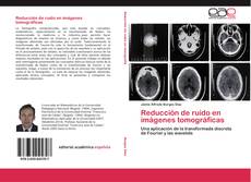 Bookcover of Reducción de ruido en imágenes tomográficas