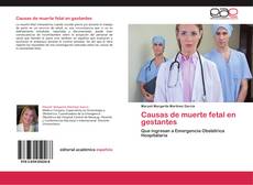 Bookcover of Causas de muerte fetal en gestantes