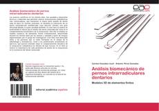 Análisis biomecánico de pernos intrarradiculares dentarios kitap kapağı