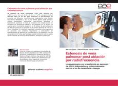 Bookcover of Estenosis de vena pulmonar post ablación por radiofrecuencia