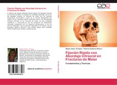Buchcover von Fijación Rígida con Abordaje Intraoral en Fracturas de Malar