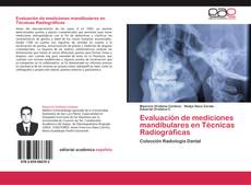 Bookcover of Evaluación de mediciones mandibulares en Técnicas Radiográficas