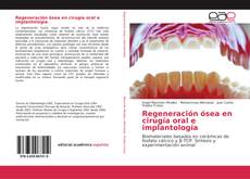 Copertina di Regeneración ósea en cirugía oral e implantología
