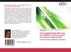 Bookcover of Inmunogammagrafía con los AcM ior-c5 e ior-cea1 en cáncer colorrectal