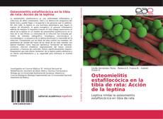 Bookcover of Osteomielitis estafilocócica en la tibia de rata: Acción de la leptina