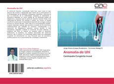 Bookcover of Anomalía de Uhl