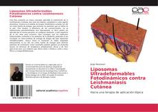 Copertina di Liposomas Ultradeformables Fotodinámicos contra Leishmaniasis Cutánea