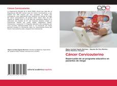Bookcover of Cáncer Cervicouterino