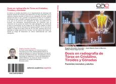 Обложка Dosis en radiografía de Tórax en Cristalino, Tiroides y Gónadas