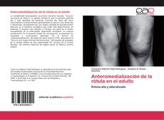 Обложка Anteromedialización de la rótula en el adulto