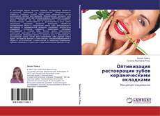 Bookcover of Оптимизация реставрации зубов керамическими вкладками