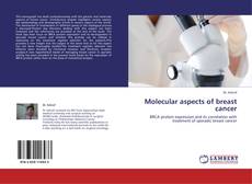 Couverture de Molecular aspects of breast cancer
