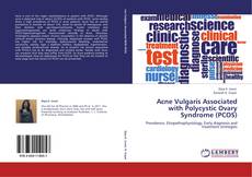 Buchcover von Acne Vulgaris Associated with Polycystic Ovary Syndrome (PCOS)
