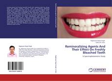 Capa do livro de Remineralizing Agents And Their Effect On Freshly Bleached Teeth 