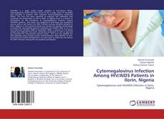 Bookcover of Cytomegalovirus Infection Among HIV/AIDS Patients in Ilorin, Nigeria
