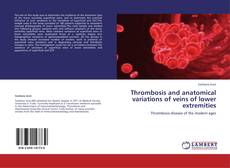 Buchcover von Thrombosis and anatomical variations of veins of lower extremities