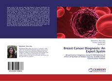 Bookcover of Breast Cancer Diagnosis: An Expert Systm