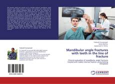 Mandibular angle fractures with teeth in the line of fracture kitap kapağı