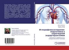 Bookcover of Иглорефлексотерапия: подготовка к каротидной эндартерэктомии