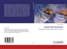 Buchcover von Basal Cell Carcinoma