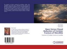 Capa do livro de Open Versus Closed Reduction of Conlylar Fracture of Mandible 