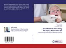 Buchcover von Attachments retaining implant overdentures
