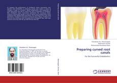 Capa do livro de Preparing curved root canals 
