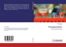 Bookcover of Transplantation