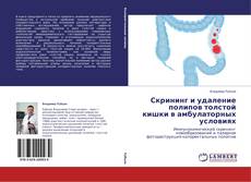 Buchcover von Скрининг и удаление полипов толстой кишки в амбулаторных условиях
