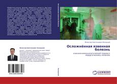 Buchcover von Осложнённая язвенная болезнь