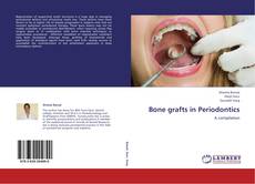 Buchcover von Bone grafts in Periodontics