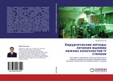 Bookcover of Хирургические методы лечения ишемии нижних конечностей IV степени