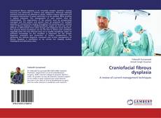 Bookcover of Craniofacial fibrous dysplasia