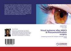 Capa do livro de Visual outcome after MSICS & Phacoemulsification surgery 