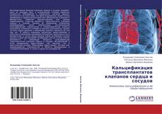 Обложка Кальцификация трансплантатов клапанов сердца и сосудов