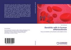 Buchcover von Dendritic cells in human atherosclerosis