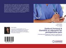 Couverture de Epidural Fentanyl & Clonidine as adjuvants for postoperative pain