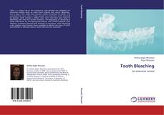 Bookcover of Tooth Bleaching
