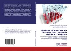 Bookcover of Методы диагностики и лечения генитального герпеса у женщин