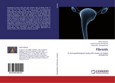 Buchcover von Fibroids