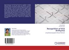 Buchcover von Recognition of ECG Arrthymia