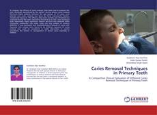 Portada del libro de Caries Removal Techniques in Primary Teeth