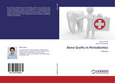 Обложка Bone Grafts in Periodontics